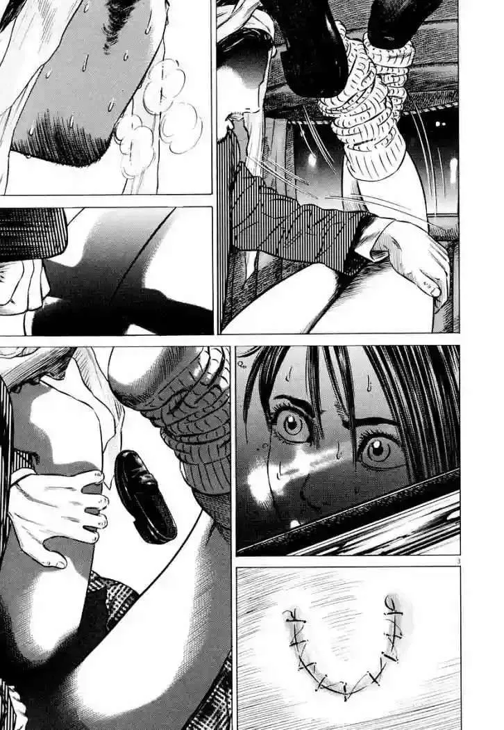 Homunculus Capítulo 25 en Línea - página 7
