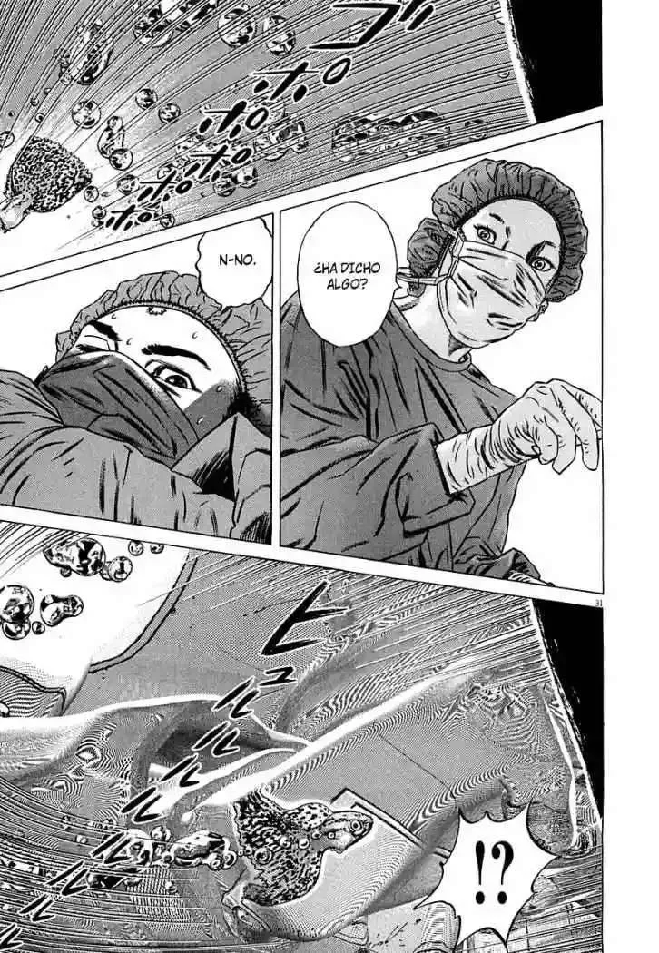 Homunculus Capítulo 32 en Línea - página 35