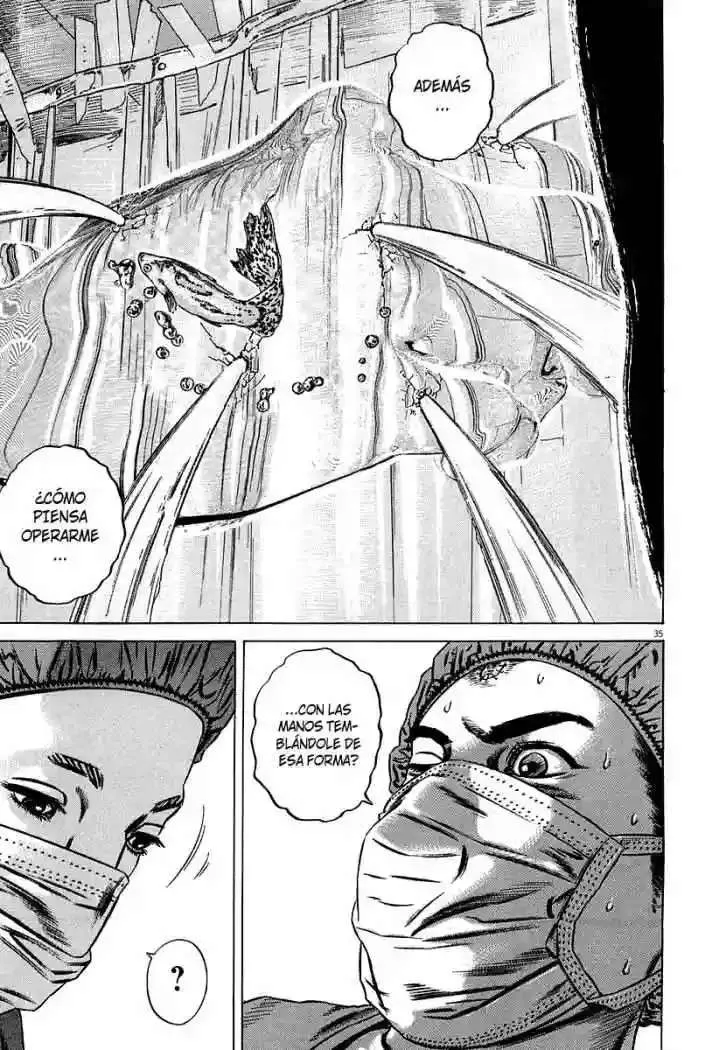 Homunculus Capítulo 32 en Línea - página 39